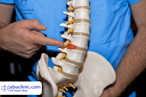 دیسک کمر، از علل و علائم تا درمان