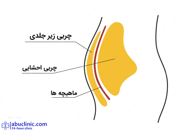 چربی احشایی چیست + عوارض